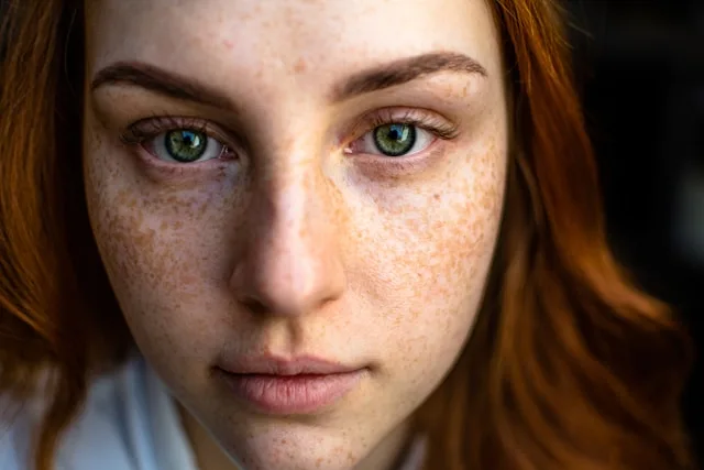 skincare-for-dry-acne-prone-skin_bloomedic.com_